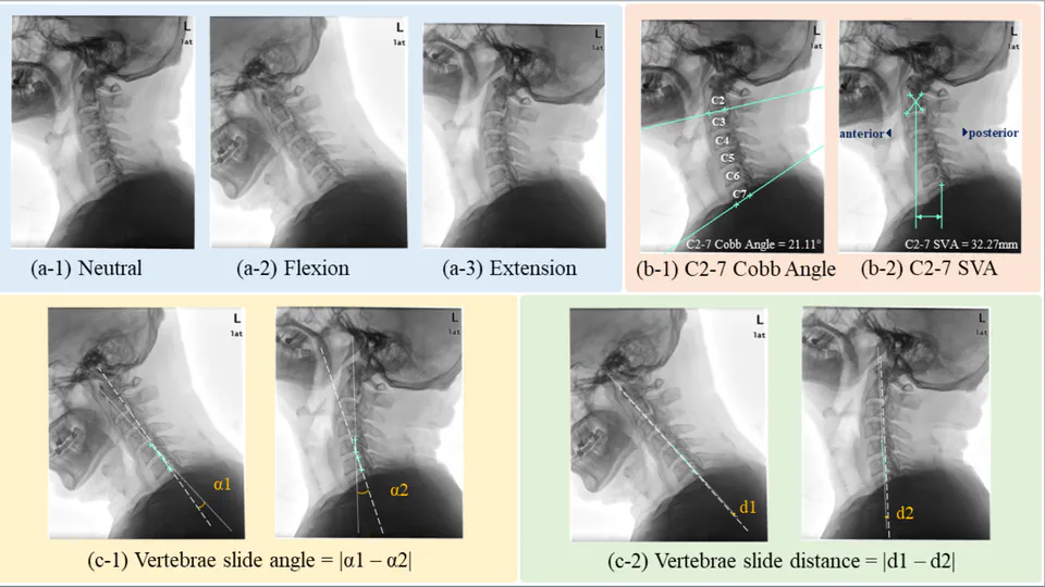 [Research Paper] Knowledge-Guided Gated Multitasking Network for Cervical Spine Degeneration Evaluation